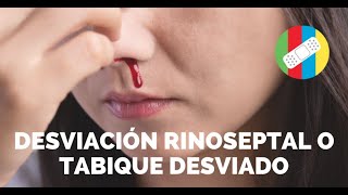 Desviación Rinoseptal o Tabique desviado [upl. by Camille296]