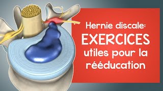 Hernie discale  des exercices utiles pour la rééducation [upl. by Dilisio]