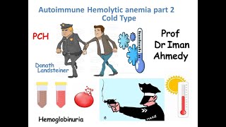 Autoimmune Hemolytic Anemia part 2 cold type [upl. by Ettecul]