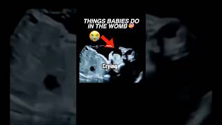 Things babies do in the womb ultrasound pregnancy baby cutebaby womenshealth [upl. by Tenej195]