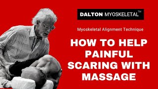 How to Help Painful Scarring with Massage [upl. by Ikciv]