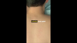 Quick Relief from Arthritis Neck Pain shorts [upl. by Domingo370]