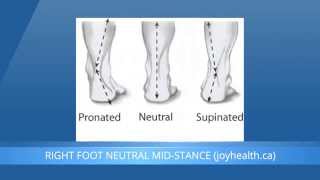 Foot Pronation And Supination  What Is The Difference [upl. by Rawde]