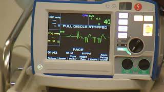 R Series Plus Transcutaneous Pacing [upl. by Pearline]