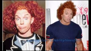 Carrot Top Plastic Surgery Before and After HD [upl. by Ilaire]