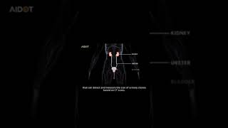 URO dot AI AI based urinary stone detection system [upl. by Thackeray806]