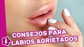 Labios agrietados consejos para que no se pelen tus labios [upl. by Omik]