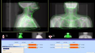 Applications of ImageGuided Radiotherapy [upl. by Neddra549]