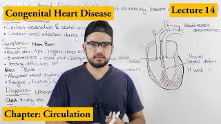 Congenital Heart Diseases Cardiovascular Disorders  Chapter Circulation video  14 [upl. by Lumbye]