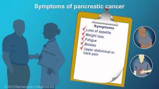 Mayo Clinic Minute When colon cancer spreads to the liver [upl. by Rica765]