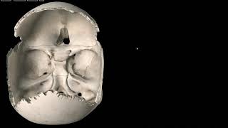 The Sphenoid Bone [upl. by Plossl]