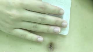 magnetic abdominal slimming patch [upl. by Mehsah]