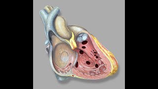 Ventricular Septal Defects by D Bailly  OPENPediatrics [upl. by Hanikahs449]