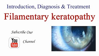 Filamentary Keratopathy  Keratitis Introduction Causes Diagnosis and Treatment  Optometry Club [upl. by Barta]