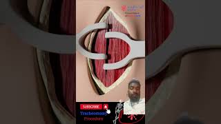 Tracheostomy 3danimationsurgery satisfying medicalanimation trachea doctor anatomy facts [upl. by Aeniah316]