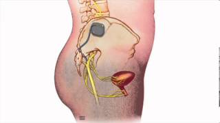 Fecal Incontinence  Heidi Chua MD  Mayo Clinic [upl. by Aleina]