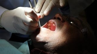 How 1 drug can regrow teeth [upl. by Alial509]