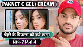 Paknet c gel uses dose benefits and Side effects full review in hindi [upl. by Norrad]