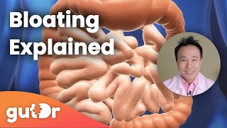 Bloating  The GutDr Explains 3D Gut Animation [upl. by Sterling432]