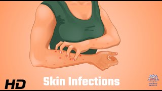 Skin Infections Uncovered What Your Dermatologist Wants You to Know [upl. by Aihsaei]