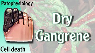 Dry Gangrene Necrosis شرح [upl. by Ecerahs]