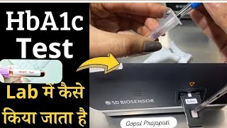 HbA1c test full procedureHbA1c test कैसे किया जाता हैं HbA1c test by SD BIOSENSER f200 Dr Gopal [upl. by Stillas256]