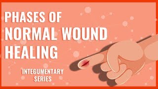 Phases of Normal Wound Healing [upl. by Caressa356]