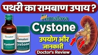 kidney stone  Himalaya cystone tablet review [upl. by Enyrb]