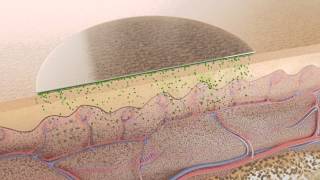 Pflaster als therapeutisches System [upl. by Ddarb]