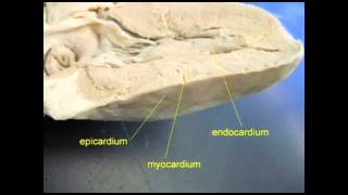 AP2 EXAM 1 HEART MYOCARDIUMavi [upl. by Acirfa]