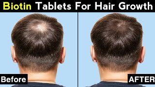 Biotin For Hair Growth  Biotin And Multivitamin Tablets For Hair Growth  Shorts [upl. by Ciccia720]