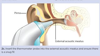 Tympanic Membrane Temperature Measurement  How to Use Tympanic Thermometer  Body Temperature [upl. by Tecil]