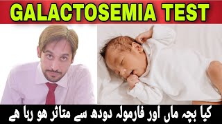 Galactosemia Test  Galactosemia Disease  Galactosemia Kya Hai [upl. by Giark]