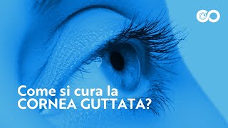 Come si cura la cornea guttata [upl. by Ayatahs]