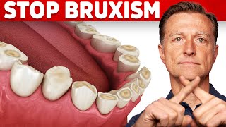 The Best 2 Remedies for Teeth Grinding Bruxism [upl. by Ardnaed652]