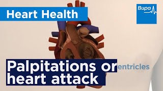 Palpitations or heart attack what is it  Bupa Health [upl. by Sargent]