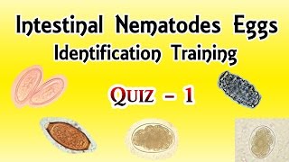 Intestinal Nematodes Eggs Identification Training Quiz 14 [upl. by Erland]