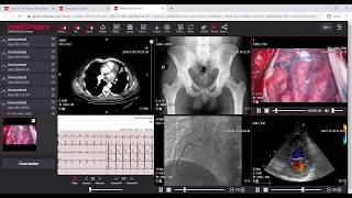 MedDream DICOM Viewer introduction [upl. by Asiulana]