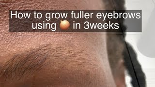 How To Grow Thicker Eyebrows Naturally and Faster [upl. by Lecrad438]