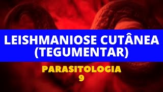 LEISHMANIOSE CUTÂNEA TEGUMENTAR  PARASITOLOGIA 9 [upl. by Neddy]