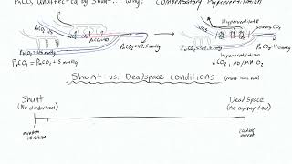 Shunt 3  VQ mismatch spectrum [upl. by Eul]