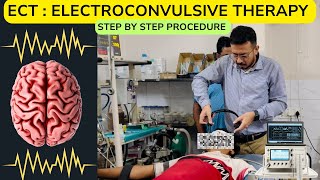 ECT  Electroconvulsive Therapy Real Video। मानसिक बीमारियों के लिए ब्रह्मास्त्र [upl. by Aicilehp552]