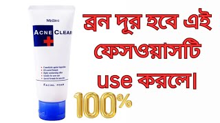 Mistine Acne Clear Facial Foam Face WashMistine Acne Clear Face Wash reviewhow to useBangla [upl. by Ailaroc877]