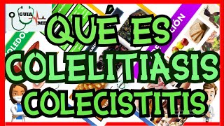 QUÉ ES COLELITIASIS Y COLECISTITIS  GuiaMed [upl. by Anaej]