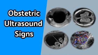 Obstetric Ultrasound Signs [upl. by Otes37]