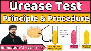 🧫 Urease Test for Identification of Bacteria  Principle amp Procedure  Microbiology Lab Practical [upl. by Johnsson]