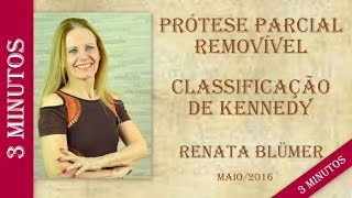 RESUMO  CLASSIFICAÃ‡ÃƒO DE KENNEDY e REGRAS DE APPLEGATE  PRÃ“TESE PARCIAL REMOVÃVEL [upl. by Netti]