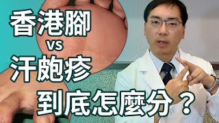 香港腳 vs 汗皰疹，到底怎麼區分？ [upl. by Aholla]