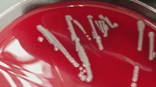 Microbiology Normal flora versus Pathogens [upl. by Ecadnac]