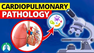 Cardiopulmonary Pathology  Heart and Lung Diseases [upl. by Otir]